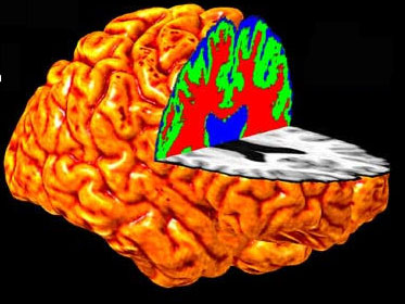 Illustration for article titled This Is What Game Consoles Really Do To Your Brain